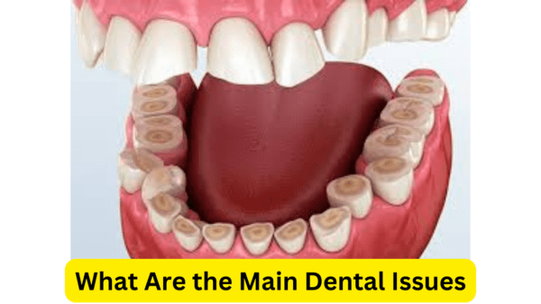 What Are the Main Dental Issues