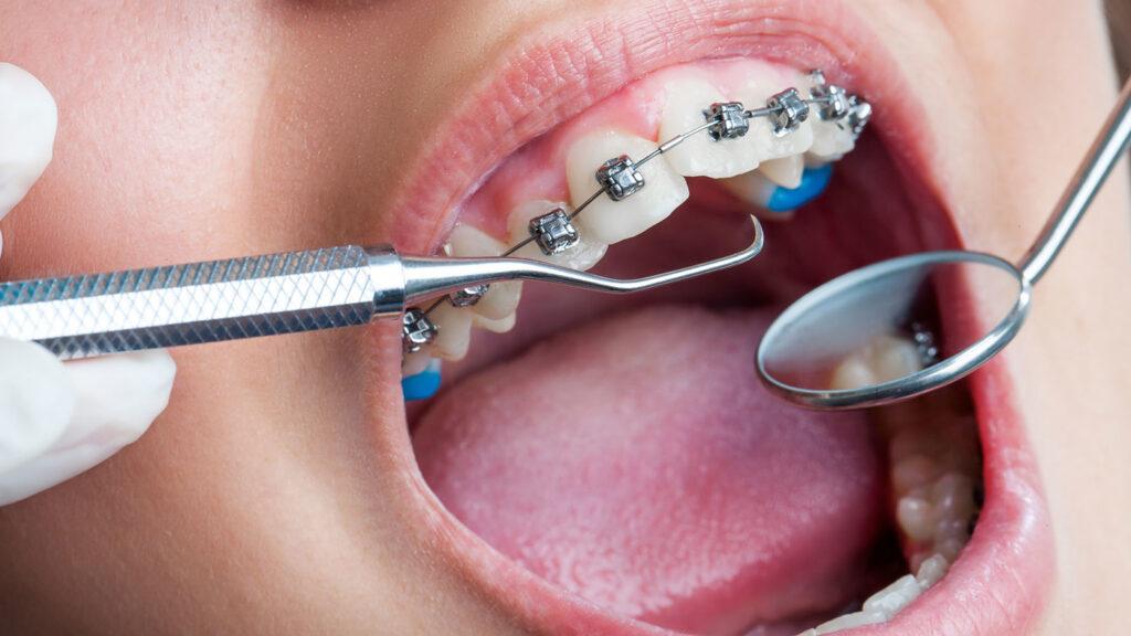 What is the Importance of Dental Health